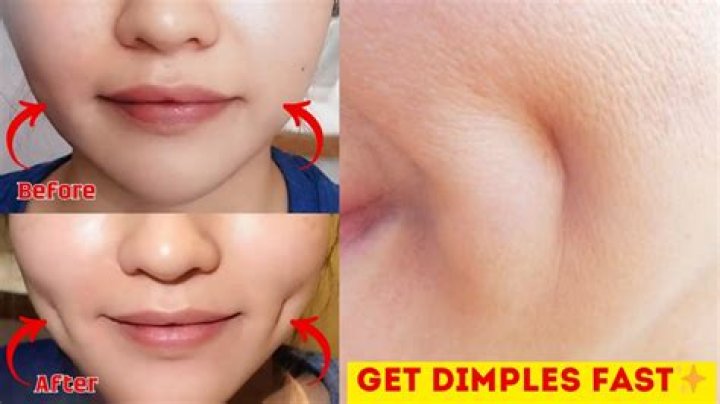 Exploring The Allure Of The Biggest Dimples