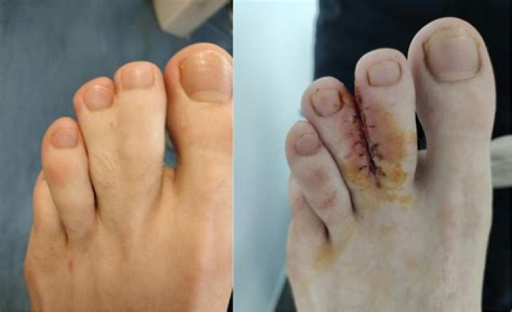 Exploring The Fascination Behind Interlocked Toes