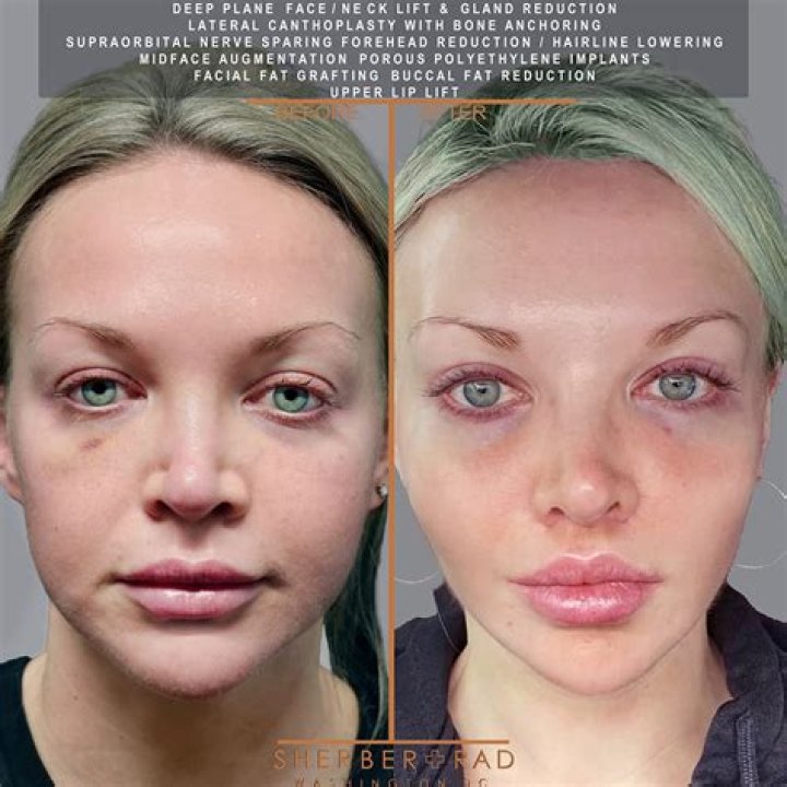 Kimber Jaynes: The Story Behind Her Botched Procedures