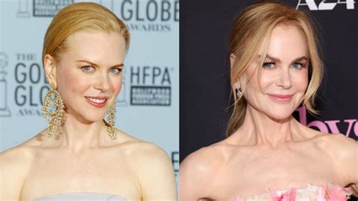 Remarkable Transformation: Nicole Kidman's Plastic Surgery Journey