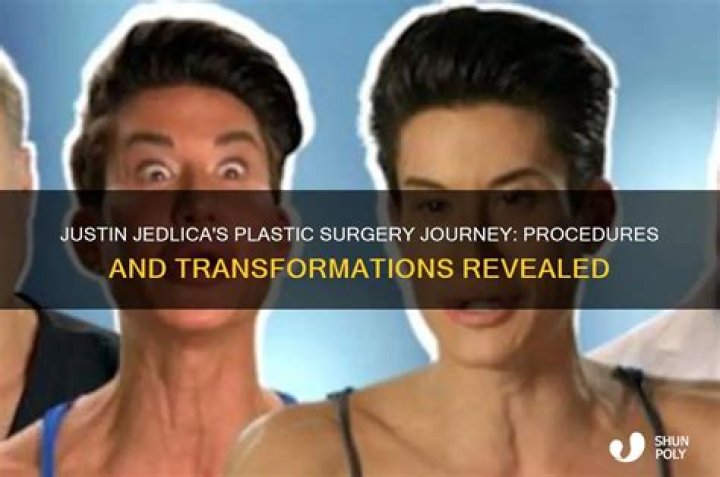 Transforming Beauty: The Journey Of Justin Jedlica And His Plastic Surgery