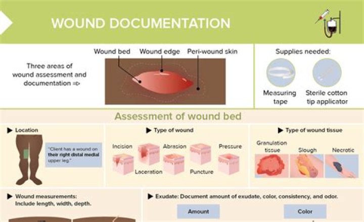 Understanding The Concerns Of A Smelly C Section Incision
