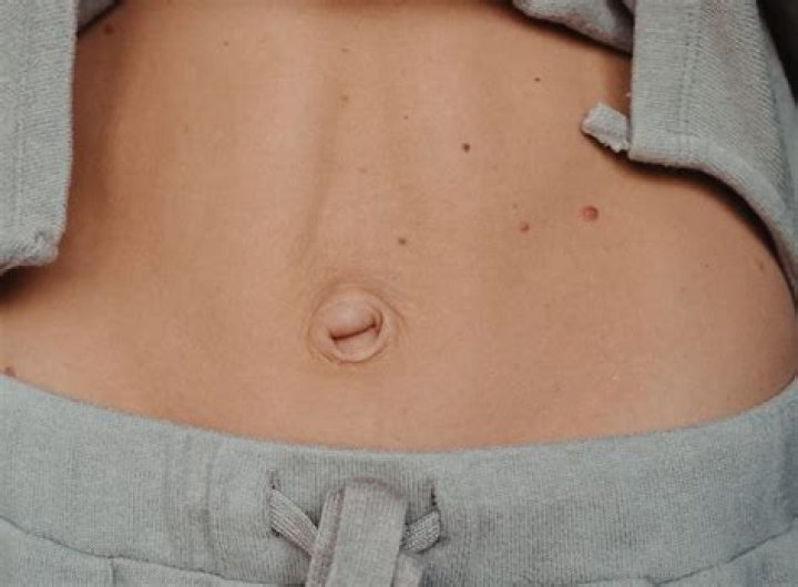 Unveiling The Fascinating World Of Belly Button Mold