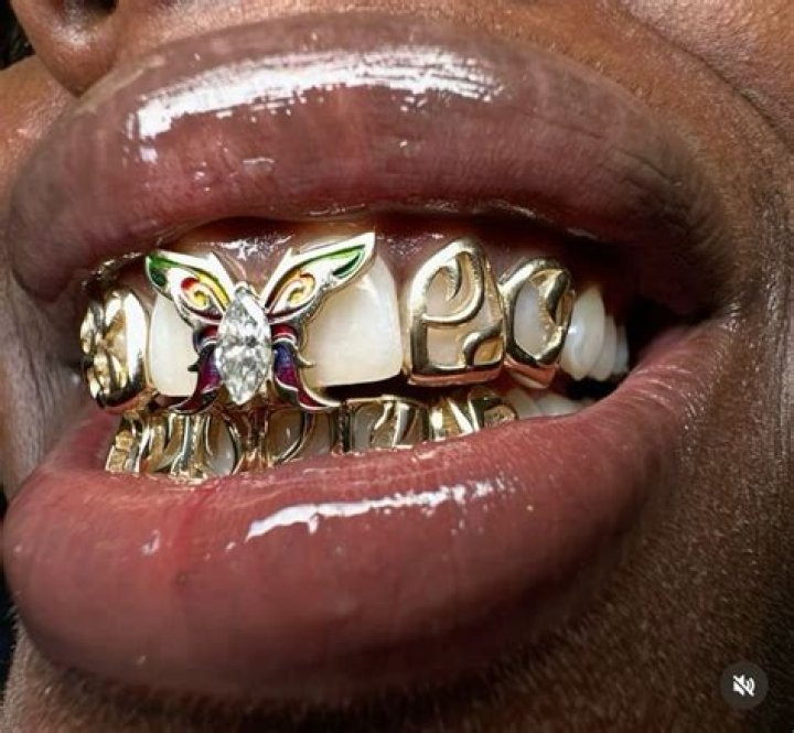 Unveiling The Sparkle: A Comprehensive Review Of Grillz By Scotty